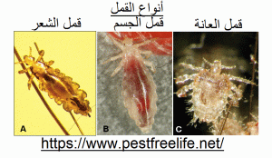 توضيح أنواع القمل headlouse types